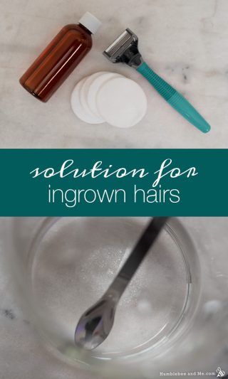 Banish ingrown hairs with my DIY version of Tend Skin